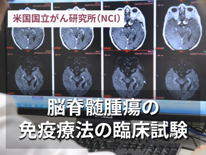 脳脊髄腫瘍の免疫療法の臨床試験の画像