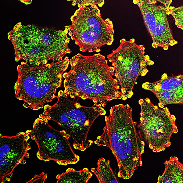 血中の腫瘍DNAが免疫療法のバイオマーカーとなる可能性の画像