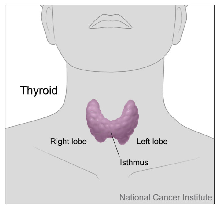 甲状腺がんのリンパ節切除のための“転移確率”データの画像